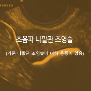 초음파 나팔관 조영술